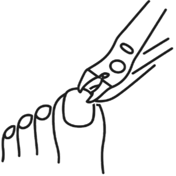 Coupe d'ongles sur Neuchâtel